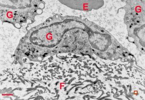 clotted blood - fibrin and granulocytes